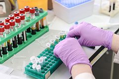 Страшный и очень всераспространенный миф о раке развеяли