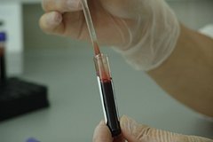 Названы главные предпосылки распространения венерических заболеваний в мире