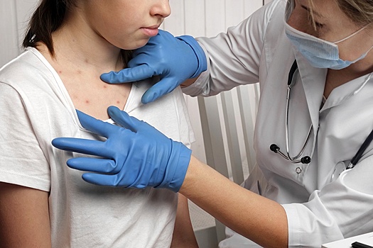 В России стартуют клинические исследования новой вакцины от ветрянки