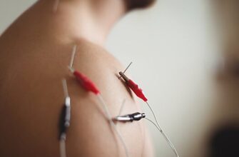 Ekspert rasskazal kogda naznachaetsja elektronejromiografija 69c8c2a.jpg